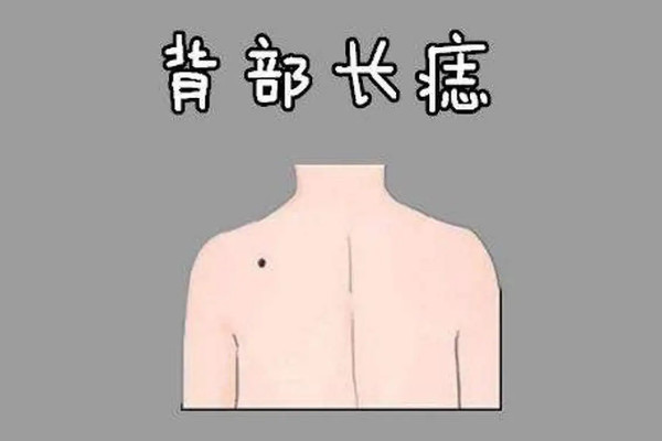 网络配图 网络配图