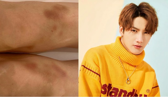 网络配图 网络配图